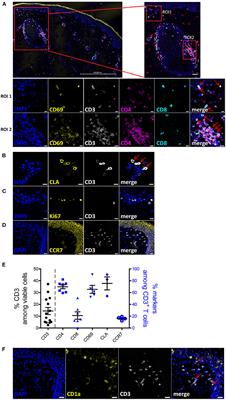 Rapid Isolation of Functional ex vivo Human Skin Tissue-Resident Memory T Lymphocytes